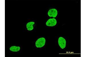 Immunofluorescence of monoclonal antibody to VPS8 on HeLa cell. (VPS8 抗体  (AA 1329-1428))