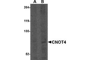 Western Blotting (WB) image for anti-CCR4-NOT Transcription Complex Subunit 4 (CNOT4) (N-Term) antibody (ABIN1031324)