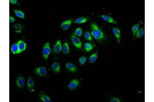 Immunofluorescence staining of A549 cells with ABIN7148470 at 1:66, counter-stained with DAPI. (Contactin 1 抗体  (AA 686-866))