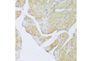 Immunohistochemistry of paraffin-embedded rat heart using DENR antibody (ABIN6133498, ABIN6139534, ABIN6139535 and ABIN6217790) at dilution of 1:150 (40x lens). (Density Regulated Protein 抗体  (AA 1-198))