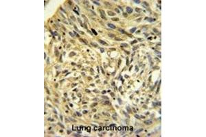 Immunohistochemistry (IHC) image for anti-FK506 Binding Protein 14, 22 KDa (FKBP14) antibody (ABIN3002691) (FKBP14 抗体)