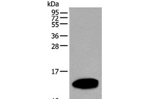 Western blot analysis of Human pancreas tissue lysate using REG1A Polyclonal Antibody at dilution of 1:500 (REG1A 抗体)