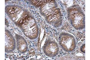IHC-P Image GBP3 antibody [N1C1] detects GBP3 protein at cytoplasm in human colon by immunohistochemical analysis. (GBP3 抗体)