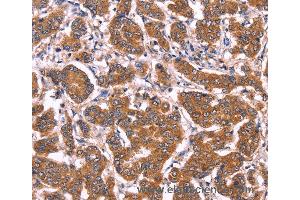 Immunohistochemistry of Human tonsil using COL20A1 Polyclonal Antibody at dilution of 1:40 (COL20A1 抗体)
