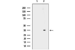 anti-Docking Protein 5 (DOK5) (C-Term) antibody