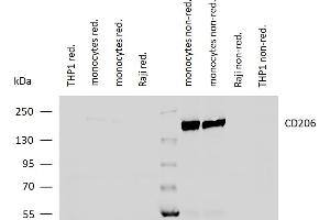 Western Blotting (WB) image for anti-Mannose Receptor, C Type 1 (MRC1) antibody (ABIN2749171)