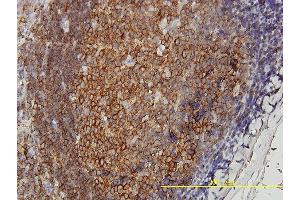 anti-DnaJ (Hsp40) Homolog, Subfamily A, Member 4 (DNAJA4) (AA 1-397) antibody