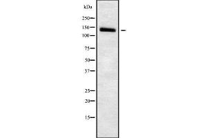 Western blot analysis SLC4A7 using HuvEc whole cell lysates (SLC4A7 抗体  (Internal Region))