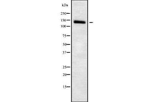 Western Blotting (WB) image for anti-Solute Carrier Family 4, Sodium Bicarbonate Cotransporter, Member 7 (SLC4A7) (Internal Region) antibody (ABIN6265137)