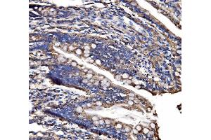 IHC analysis of CPS1 using anti-CPS1 antibody (ABIN7599871).