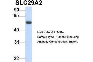 Host: Rabbit Target Name: SLC29A2 Sample Type: Human Fetal Lung Antibody Dilution: 1. (SLC29A2 抗体  (C-Term))