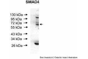 Western Blotting (WB) image for anti-SMAD Family Member 4 (SMAD4) (Middle Region) antibody (ABIN2779413) (SMAD4 抗体  (Middle Region))