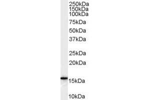 Western Blotting (WB) image for anti-DKFZp686P1551 (C-Term) antibody (ABIN2785710) (DKFZp686P1551 (C-Term) 抗体)