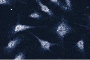 Immunofluorescence staining of human endothelial cells. (Annexin VII 抗体  (AA 34-159))