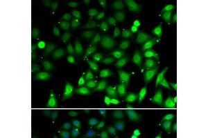 Immunofluorescence analysis of MCF-7 cells using RAE1 Polyclonal Antibody (RAE1 抗体)