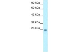 Western Blotting (WB) image for anti-General Transcription Factor IIF, Polypeptide 2, 30kDa (GTF2F2) antibody (ABIN2460222)