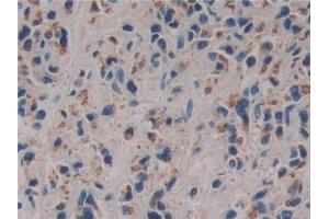 Immunohistochemistry (IHC) image for anti-Family with Sequence Similarity 3, Member C (FAM3C) (AA 25-227) antibody (ABIN7443470)