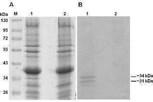 Western Blotting (WB) image for anti-Collagen, Type I (COL1) antibody (ABIN5596819)