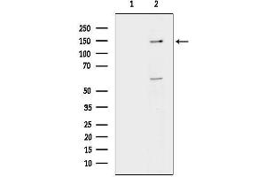 Western blot analysis of lysates from HepG2 cells(LPS 4h treatment), using MVP Antibody.