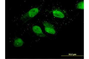 Immunofluorescence of monoclonal antibody to LOC220594 on HeLa cell. (LOC220594 (AA 255-354) 抗体)