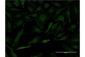 Immunofluorescence of monoclonal antibody to LETM1 on HeLa cell. (LETM1 抗体  (AA 601-708))