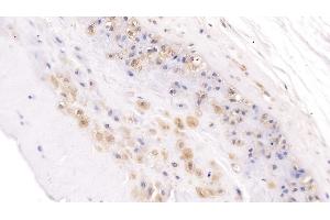 Detection of NOG in Human Placenta Tissue using Polyclonal Antibody to Noggin (NOG) (NOG 抗体  (AA 28-232))