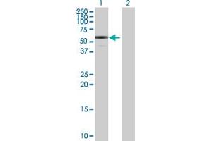 Western Blot analysis of ENTPD3 expression in transfected 293T cell line by ENTPD3 MaxPab polyclonal antibody. (ENTPD3 抗体  (AA 1-452))