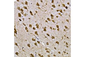 Immunohistochemistry of paraffin-embedded mouse brain using CPEB3 Rabbit pAb (ABIN7266666) at dilution of 1:300 (40x lens). (CPEB3 抗体  (AA 150-400))