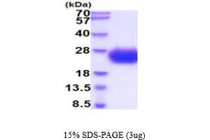 SDS-PAGE (SDS) image for Sodium Channel, Voltage-Gated, Type III, beta Subunit (SCN3B) (AA 23-159) protein (His tag) (ABIN5854809) (SCN3B Protein (AA 23-159) (His tag))