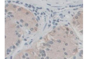 Immunohistochemistry (IHC) image for anti-N-Sulfoglucosamine Sulfohydrolase (SGSH) (AA 21-389) antibody (ABIN7436429)