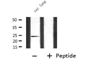 Western blot analysis of extracts from rat lung, using CDKN3 Antibody. (CDKN3 抗体  (Internal Region))