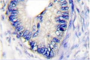 Image no. 1 for anti-Claudin 3 (CLDN3) antibody (ABIN265362) (Claudin 3 抗体)