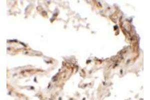Immunohistochemical analysis of EMX2 in human lung tissue with EMX2 polyclonal antibody  at 2. (EMX2 抗体  (Internal Region))