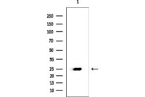 anti-Ubiquitin-Conjugating Enzyme E2D 1 (UBE2D1) (C-Term) antibody