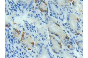 DAB staining on IHC-P; Samples: Human Stomach Tissue (BMP4 抗体  (AA 293-408))