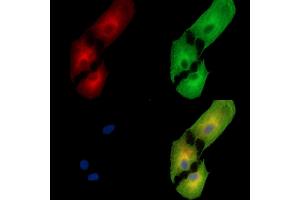 ABIN7095399 and ABIN7099456 staining  cells by IF/ICC. (C1orf114 抗体)