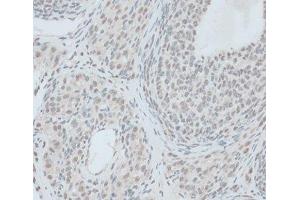 Immunohistochemistry of paraffin-embedded Rat ovary using ZNF416 Polyclonal Antibody at dilution of 1:100 (40x lens). (ZNF416 抗体)