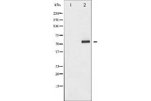 Western blot analysis of HDAC1 phosphorylation expression in EGF treated Jurkat whole cell lysates,The lane on the left is treated with the antigen-specific peptide. (HDAC1 抗体  (pSer421))