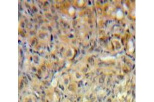 Used in DAB staining on fromalin fixed paraffin-embedded Ovary tissue (PIK3C2A 抗体  (AA 172-403))