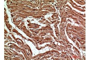 Immunohistochemistry (IHC) analysis of paraffin-embedded Human Heart, antibody was diluted at 1:200.