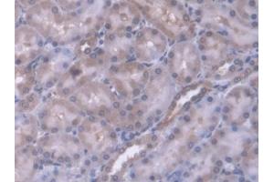 DAB staining on IHC-P; Samples: Rat Kidney Tissue (ERP29 抗体  (AA 42-173))