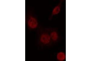 Immunofluorescence (fixed cells) (IF/ICC) image for anti-Class II, Major Histocompatibility Complex, Transactivator (CIITA) (Internal Region) antibody (ABIN6257104)