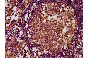 IHC image of ABIN7143386 diluted at 1:500 and staining in paraffin-embedded human lymph node tissue performed on a Leica BondTM system. (ADGRE2 抗体  (AA 151-323))