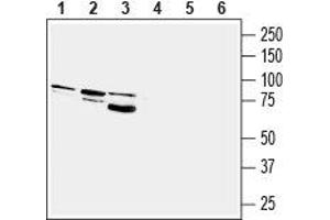 Western blot analysis of rat brain (lanes 1 and 4), mouse brain (lanes 2 and 5) and human U-87 MG glioblastoma cell line (lanes 3 and 6) lysates: - 1-3. (PTGFR 抗体  (3rd Intracellular Loop))
