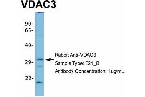 Western Blotting (WB) image for anti-Voltage-Dependent Anion Channel 3 (VDAC3) (N-Term) antibody (ABIN2776182)