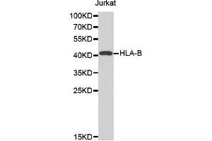 Western blot analysis of extracts of Jurkat cell line, using HLA-B antibody. (HLA-B 抗体  (AA 1-100))