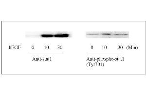 Western Blotting (WB) image for Signal Transducer and Activator of Transcription 1, 91kDa (STAT1) ELISA Kit (ABIN1981837)