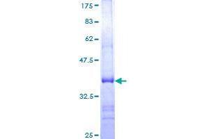 USP21 Protein (AA 466-565) (GST tag)