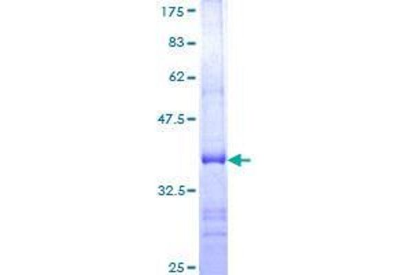 USP21 Protein (AA 466-565) (GST tag)