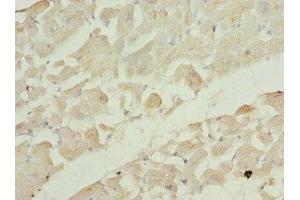 Immunohistochemistry of paraffin-embedded human heart tissue using ABIN7167216 at dilution of 1:100 (RRAS2 抗体  (AA 1-204))